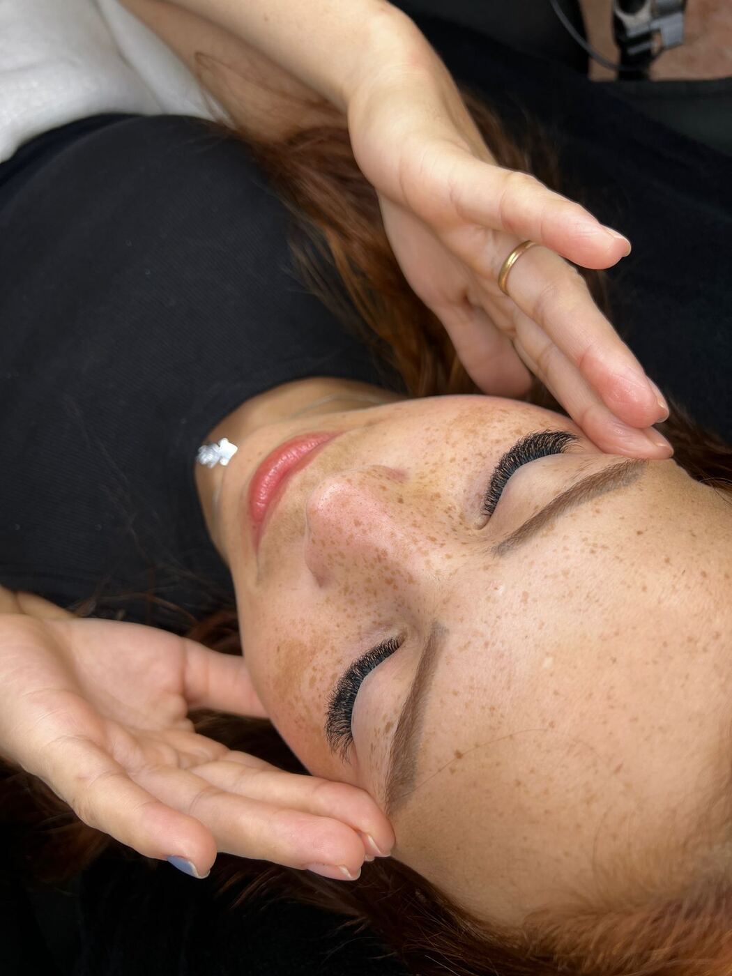 Procedimento de estética